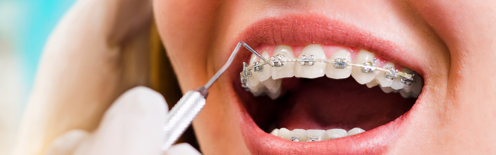 dental_img